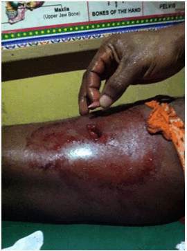 Images from Aba torture victims, legal fund website, Aba torture victims