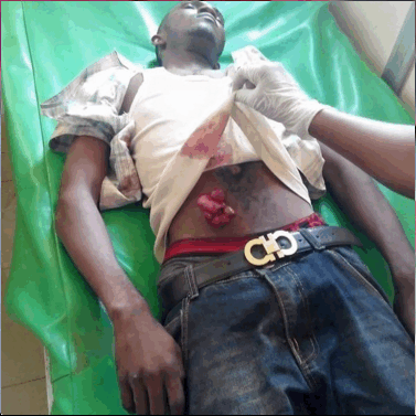 Nkpor Onitsha Torture Victims, nkpor extra judicial Killings